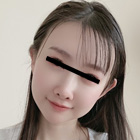 thumb2