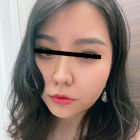 thumb5